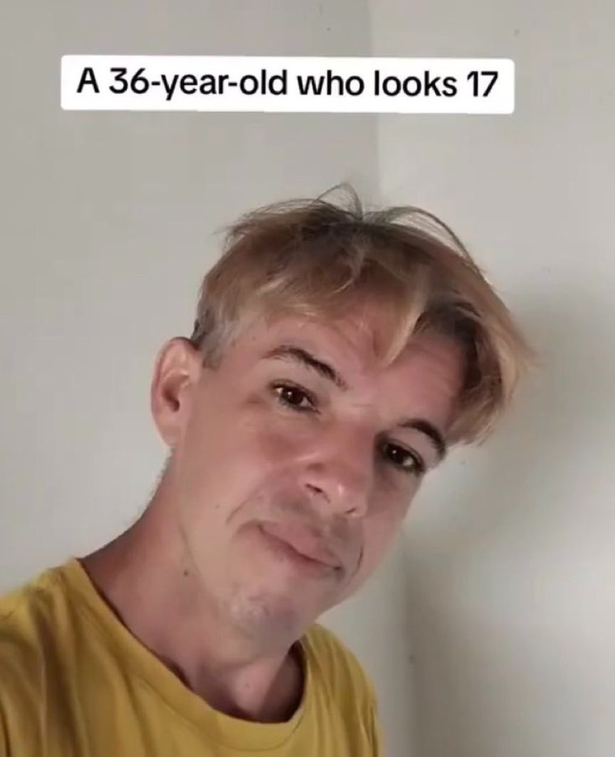 onaviro's tweet photo. this hair bro https://t.co/FgQfKmVdfl