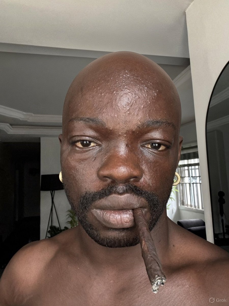 miracle9045's tweet photo. Omo if this guy go bald e own don finish be that 😂💔 https://t.co/WprqRNjcGX