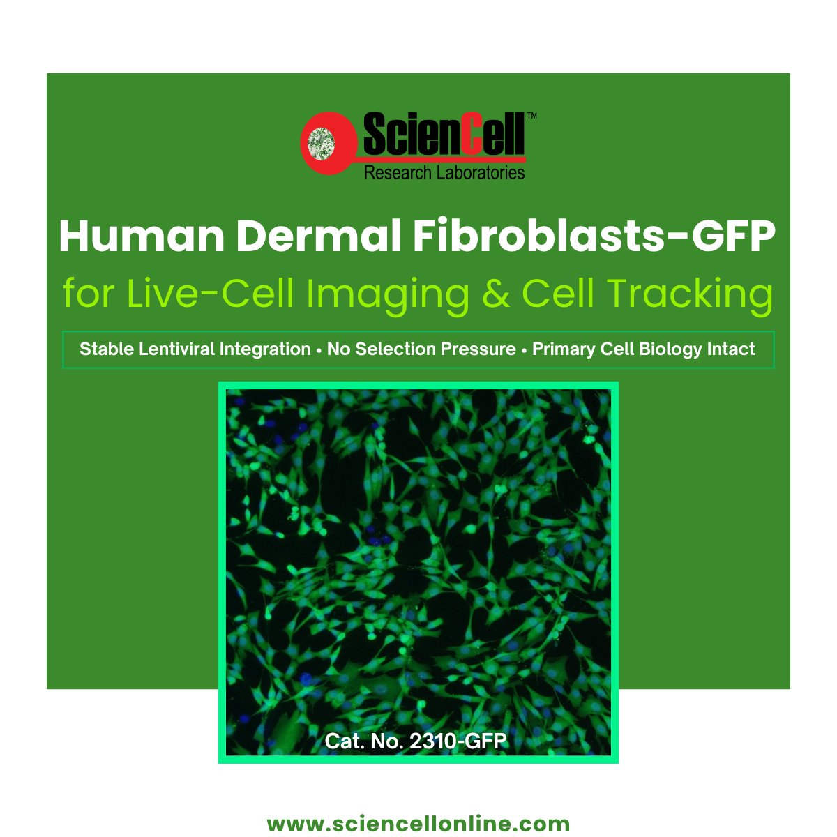 sciencell's tweet photo. Visualize fibroblast behavior in real time with Human Dermal Fibroblasts-GFP (Cat. 2310-GFP). Ideal for live-cell imaging, migration, wound healing, proliferation &amp; cell tracking. 

#Fibroblasts #LiveCellImaging https://t.co/B5Tjrioc3c