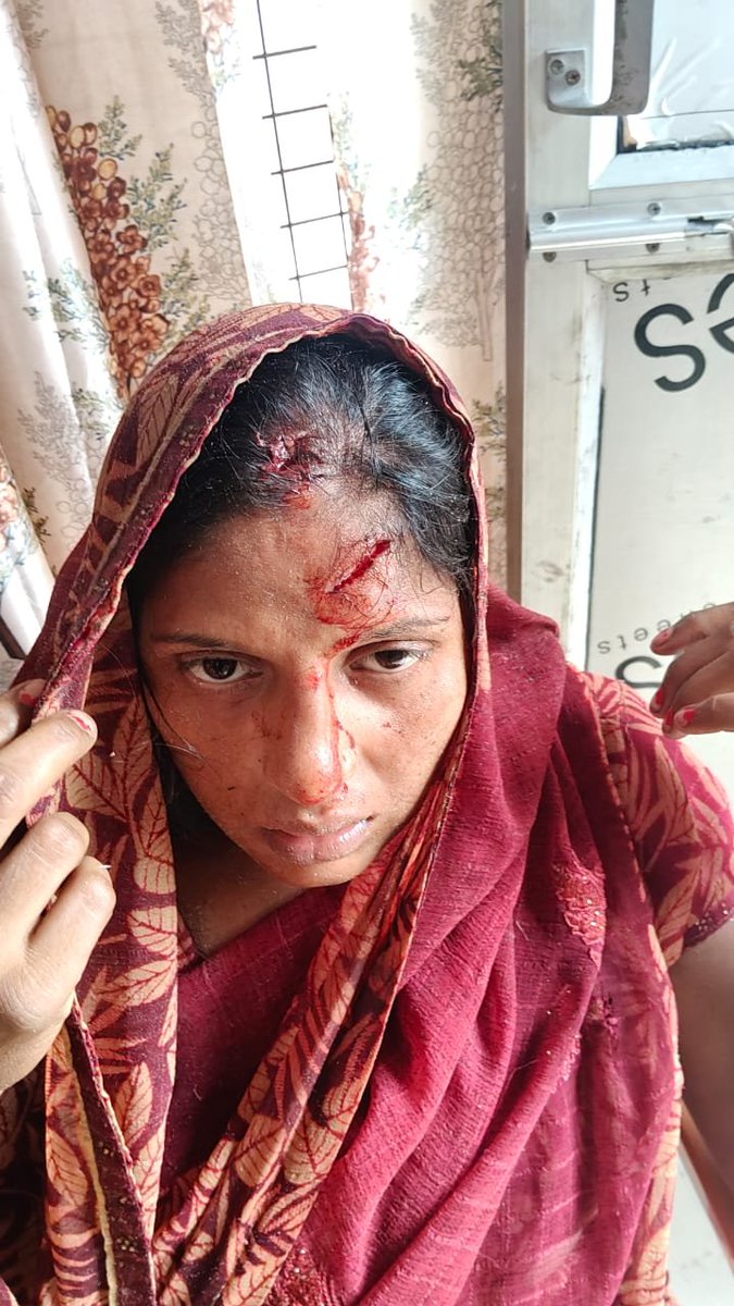 Ramveer22's tweet photo. उक्त घटना 17/08/2026 की है मेरे घर के पड़ोस मे जयप्रकाश पुत्र रामसिंह का घर है। जो जो मेरे प्लाट के आगे अपनी भैसे बांधता  है। और गाली गलौच करता है। और मेरे घर पर हमला कर दिया मेरे आँखों मे मिर्च डाल दिया और आज तक मेरी रिपोर्ट दर्ज नहीं हुई है। @dgpup @Uppolice  @sambhalpolice https://t.co/WmqsvnkHDc