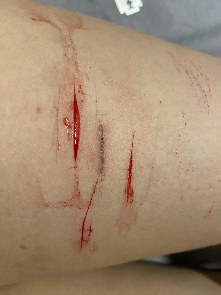 itsyournoey's tweet photo. What do u think about my new sfx makeup?? #fake all not real ai everywhere #slittwt #shedtwt #shtwt #988twt #ochietwt https://t.co/kB0zqRwBFg