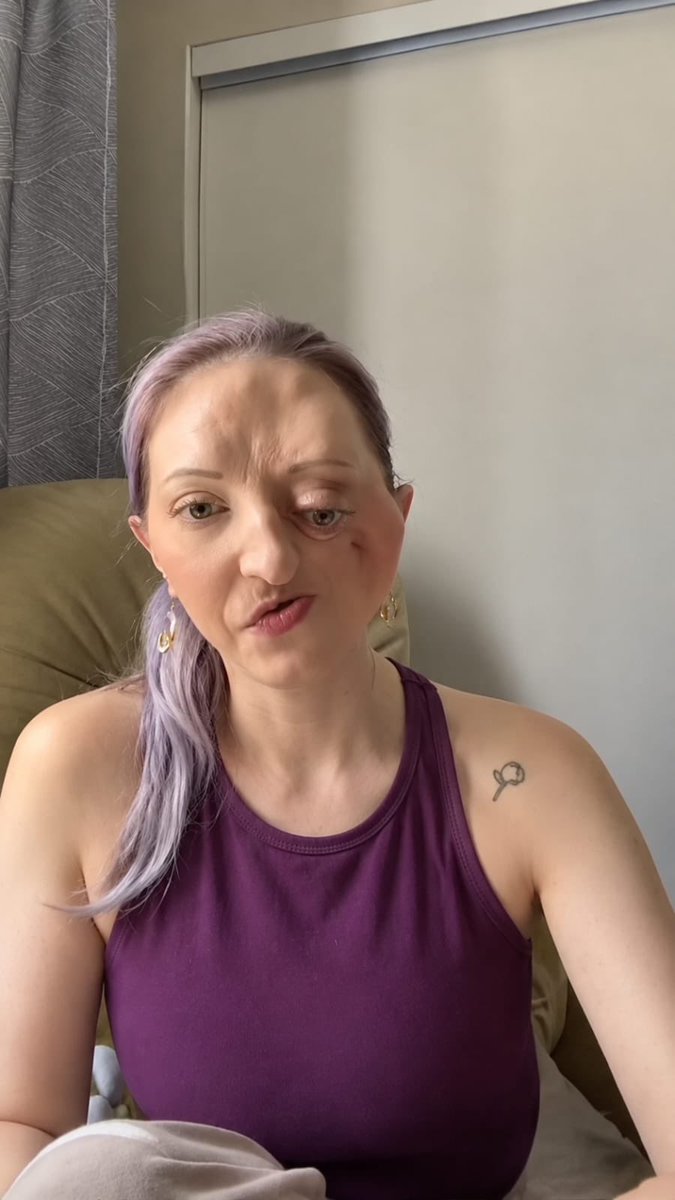 Natalie9c's tweet photo. Cancer affecting my face has turned my life upside down.
Every day brings pain, fear, and overwhelming medical bills.
Still, I’m staying strong for my family and myself.
Your support can make a real difference.
🙏 Please help: https://t.co/gV3llFjJgD