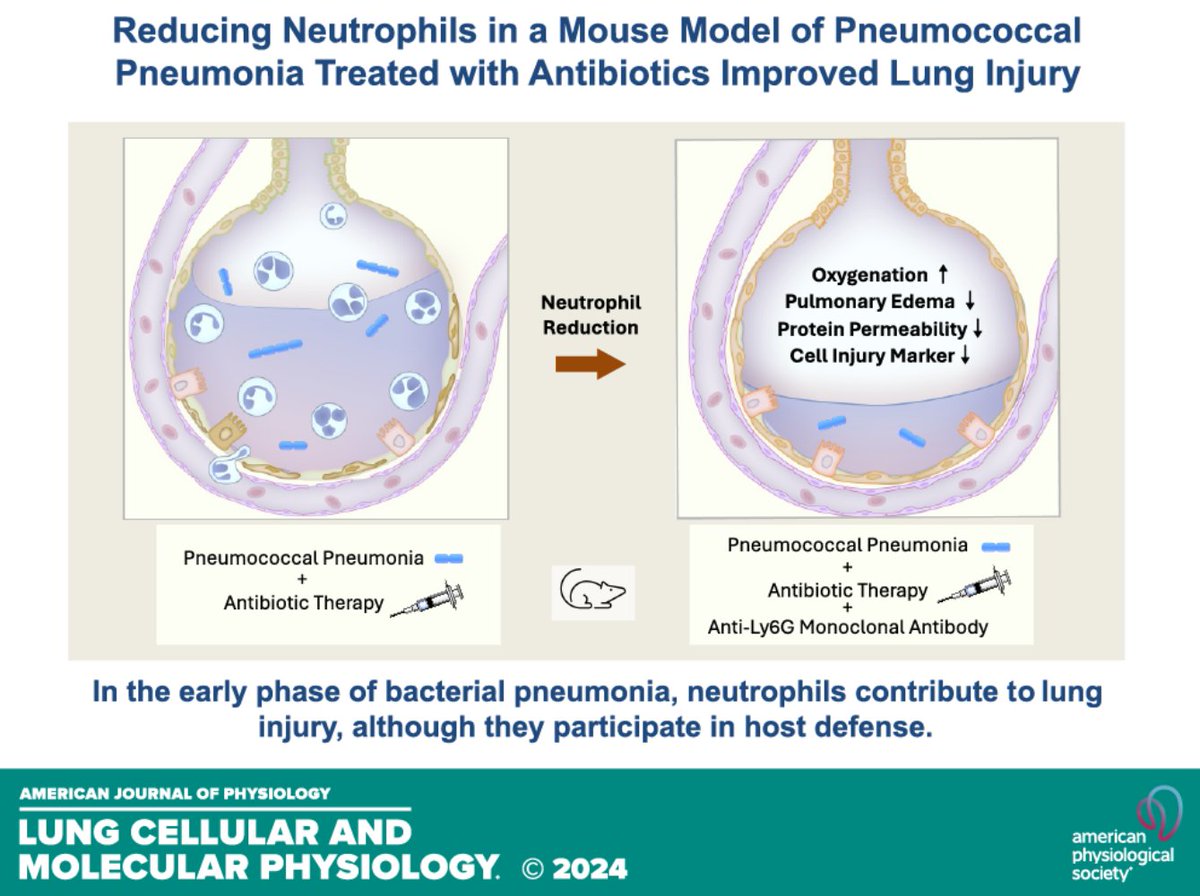 AJPLung's tweet photo. More to learn about #pneumonia in this @UCSFMedicine article, #Neutrophil reduction attenuates the severity of lung injury in the early phase of #pneumococcal pneumonia in mice (Hiroki Taenaka et al.):

https://t.co/gU59FKJqAT https://t.co/yjnw33e69E
