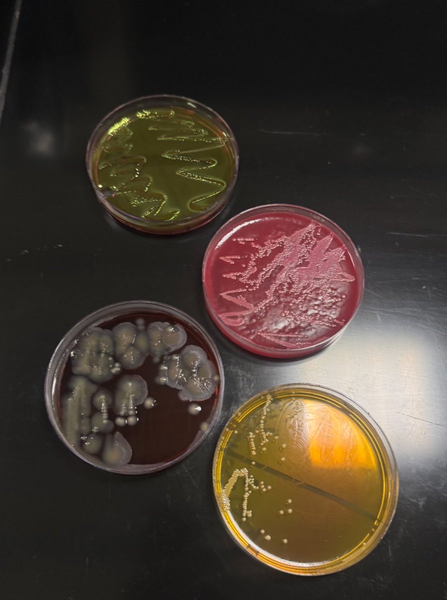 asiiisaw's tweet photo. اخيرا وصلت مرحلة اني استعمل
  Blood Agar و MacConkey Agar 
 رسميًا كبرت🫷🏻 https://t.co/Yk2Jnx6esg
