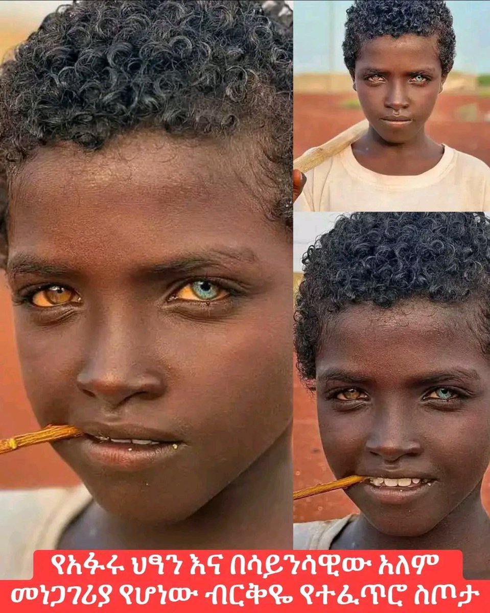 KadirIdris12's tweet photo. 🇪🇹✨ AFAR CHILD WITH NATURAL HETEROCHROMIA 👁️💛💙

A remarkable and beautiful example of human genetic diversity

a young Afar child displaying strikingly different eye colors, with one eye appearing golden-amber and the other blue-green. ✨

#Afar_Ethiopia 🇪🇹 https://t.co/9XXyjOL8Ka