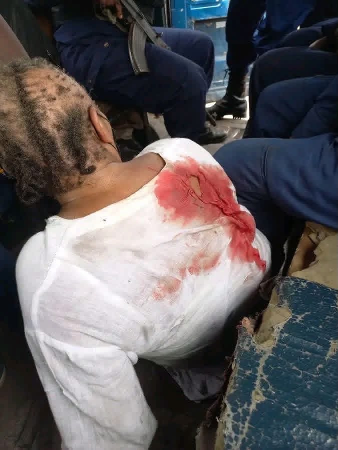 TesongoVictor's tweet photo. Ce que vous voyez, c’est le bras armé du régime : la milice fasciste Force du progrès,  une branche du parti au pouvoir. 
Sous les ordres des services de sécurité, cette structure opère en toute complicité avec la police pour réprimer l’opposition politique.
(Image du 15/09/2026) https://t.co/wwS4adzjKO