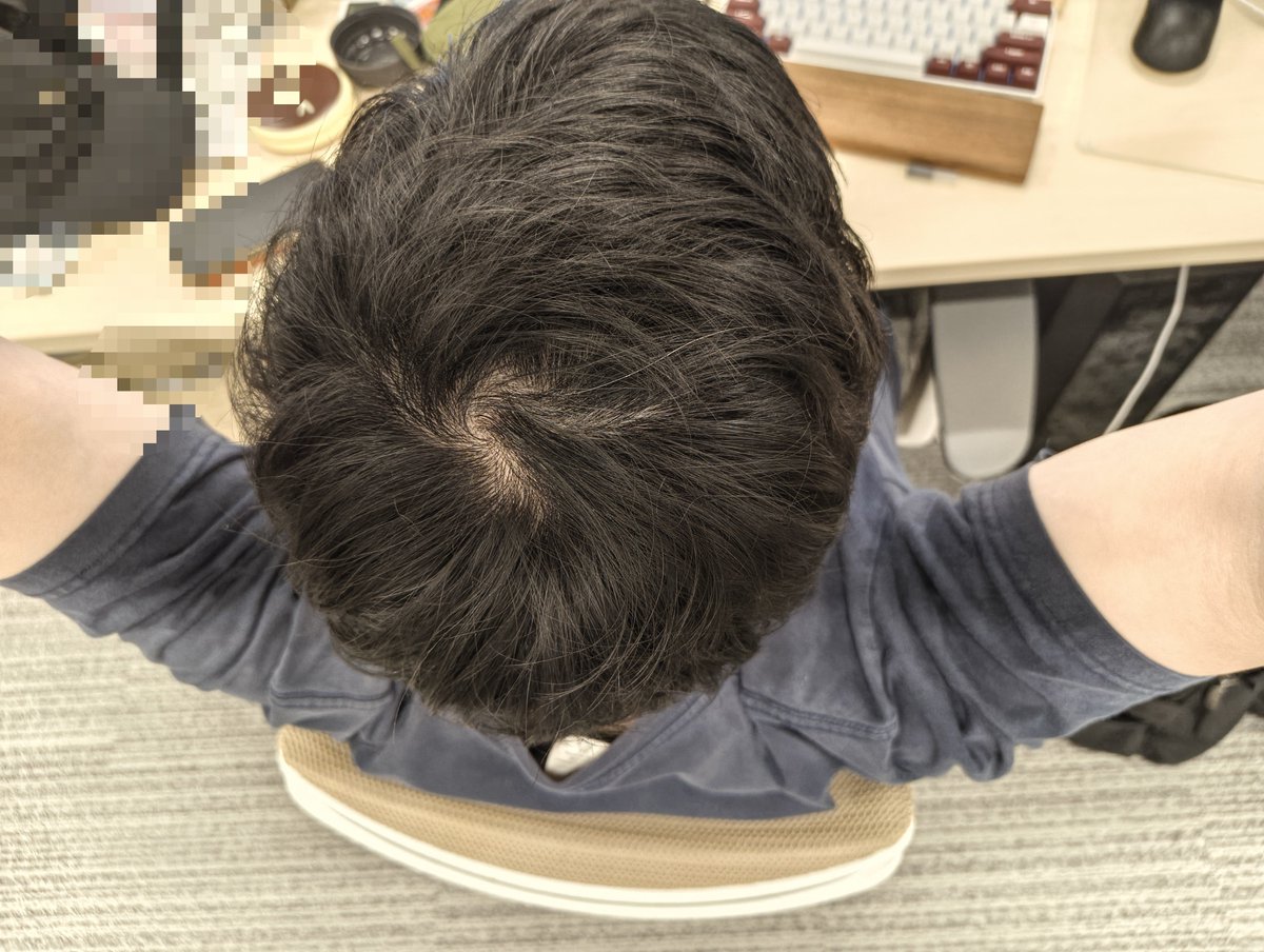 pironaly's tweet photo. 職場で髪の毛薄くなってきたねって言われた瞬間に頭頂部撮ってみたけどこれどう？ https://t.co/DCsoOnMMBC