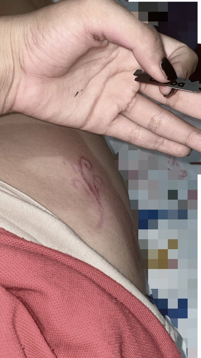 kittydee4d's tweet photo. M encantaaa yo también quería el mío ><
#fakeblood #sangrefalsa #ouchtwt https://t.co/sRmTvrySkX
