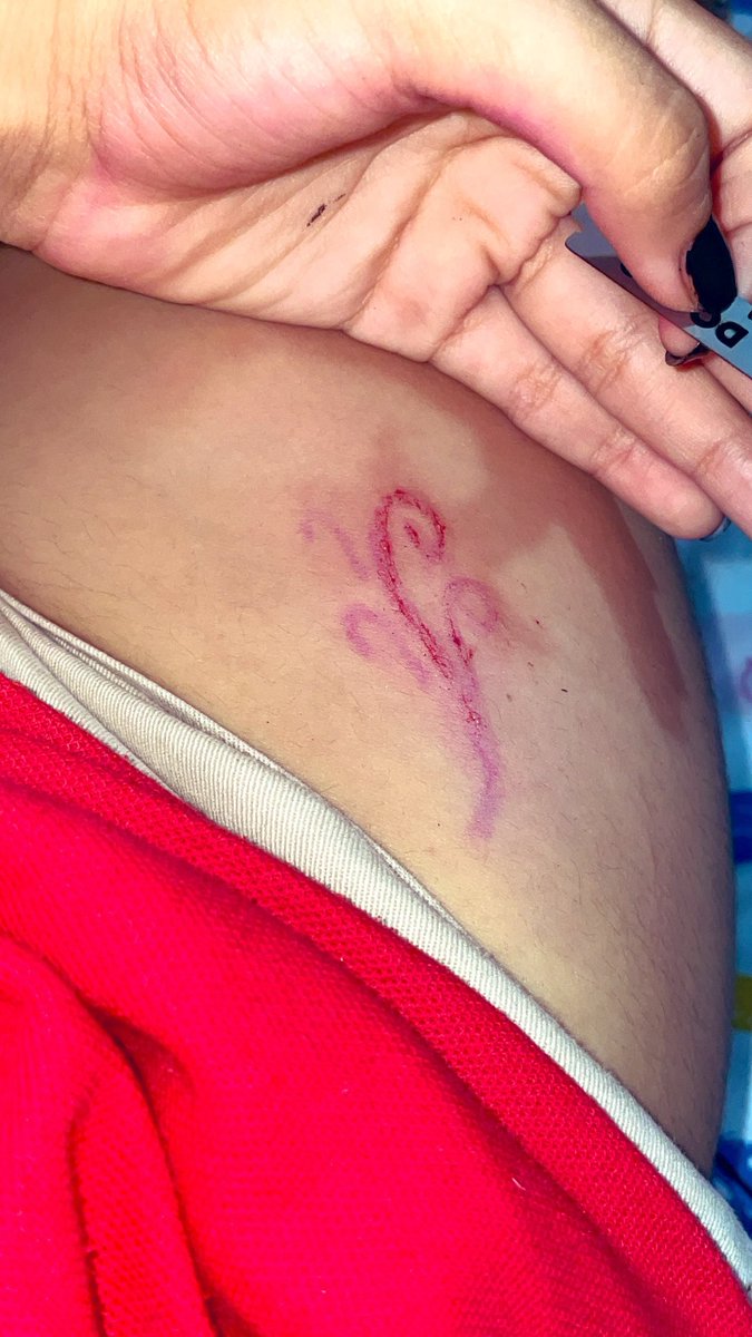 kittydee4d's tweet photo. M encantaaa yo también quería el mío ><
#fakeblood #sangrefalsa #ouchtwt https://t.co/sRmTvrySkX
