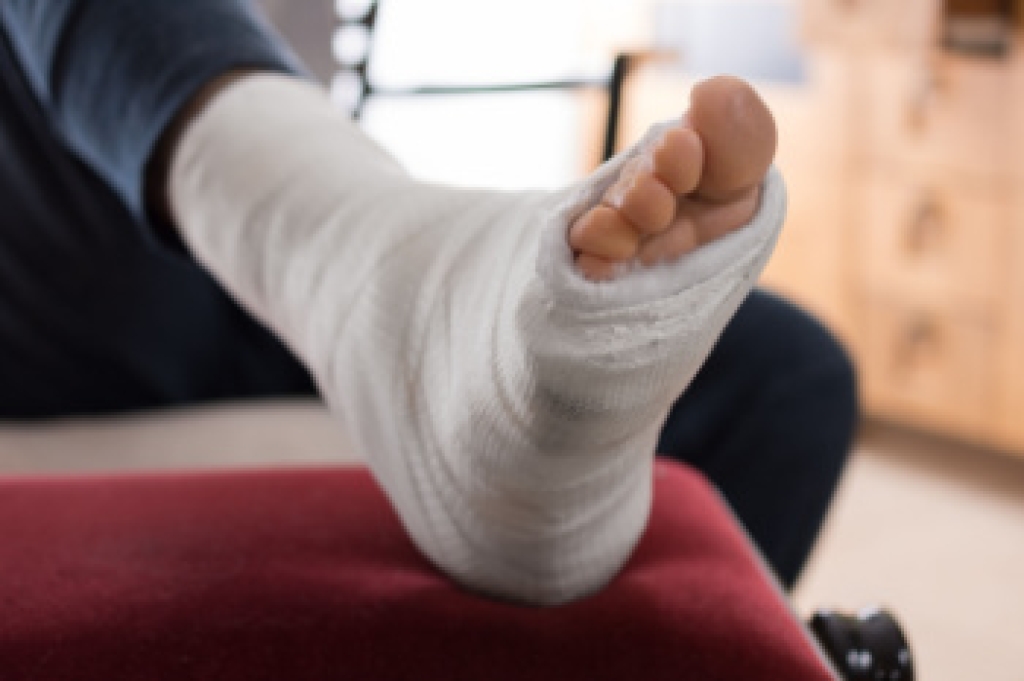 JonathanKletz's tweet photo. How to Recognize a Lisfranc Fracture https://t.co/PtZJPtuc5M https://t.co/TckFdqYR0b