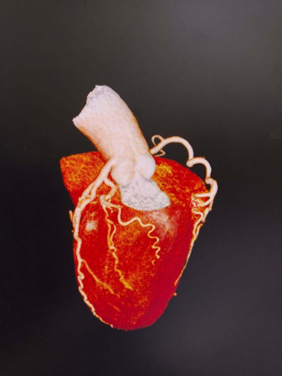 MTRHofficial's tweet photo. CT Coronary Angiography Services at MTRH

The Directorate of Radiology &amp; Imaging at Moi Teaching and Referral Hospital (MTRH) is pleased to announce the availability of high-quality CT Coronary Angiography services, enabled by the Hospital’s new 128-slice CT scanner. https://t.co/aV0USkmsBe