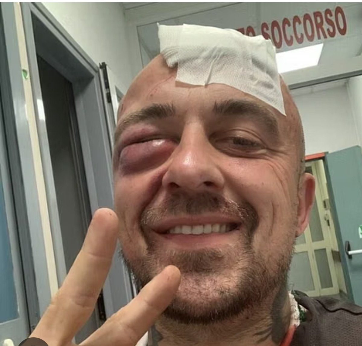 GlosweetyGlo's tweet photo. A proposito delle pedate al rabbino, per le quali, chiedete il Ddl antisemitismo, si sa niente sull'attentato per assassinare Gabriele Rubini, Chef Rubio?

È da maggio 2024 che la Digos ha judo?

Vi devono mangiare i maiali affamati, sionisti demmerda!

#Israel_IS_Nazi_Germany https://t.co/ySzqvuNAZx