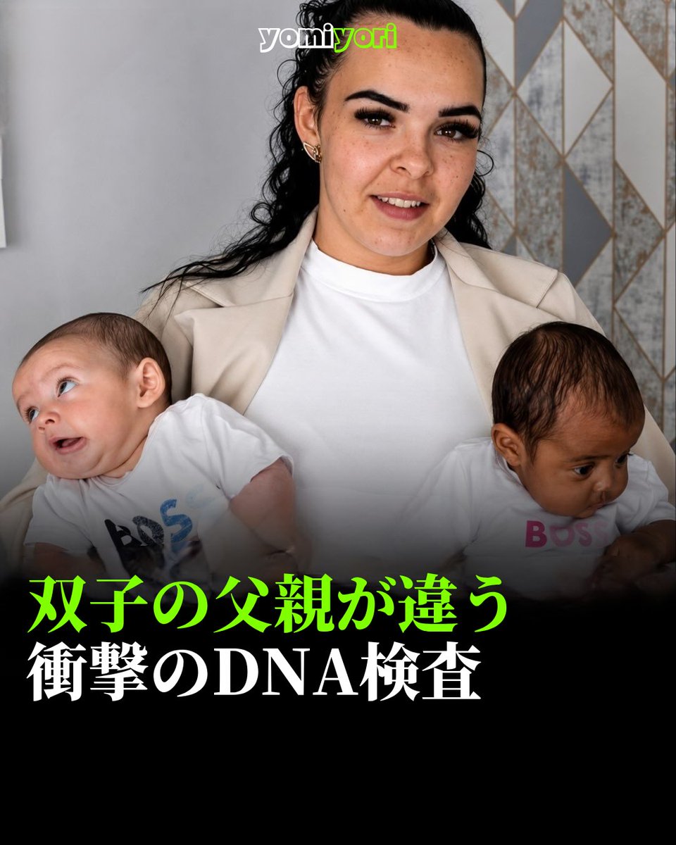 AngeloCedi9apy's tweet photo. A 19-year-old Brazilian woman gave birth to twins who were found through DNA testing to have different fathers, shocking people worldwide. This extremely rare phenomenon, called heteropaternal superfecundation, can occur when two eggs released https://t.co/PPt0qvcWAu