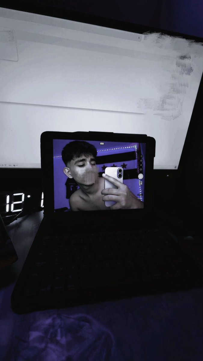 YaAZ3R's tweet photo. اوه طلع صوري❗️❗️❗️

طيب الصراحه في احله منهم خذ هذول انشرهم ع الاساس مماسك🤣🤣

و التيم تبعك سكرته بيوم خلاص ياخي والله انك ولد و اذا الرسول الناس حكت عليه انا الناس ما رح تحكي علي وك مش عيب اني بنشر صوري عيب اني اعطيتك اكثر من قيمتك المهم خذ الصورتين هذول احله من القبل و تراني مش نفسك بخاف انشر صوري بنشرها و بفتخر و الصراحه اعطيتك اكثر من قيمتك.
@Absi_151
