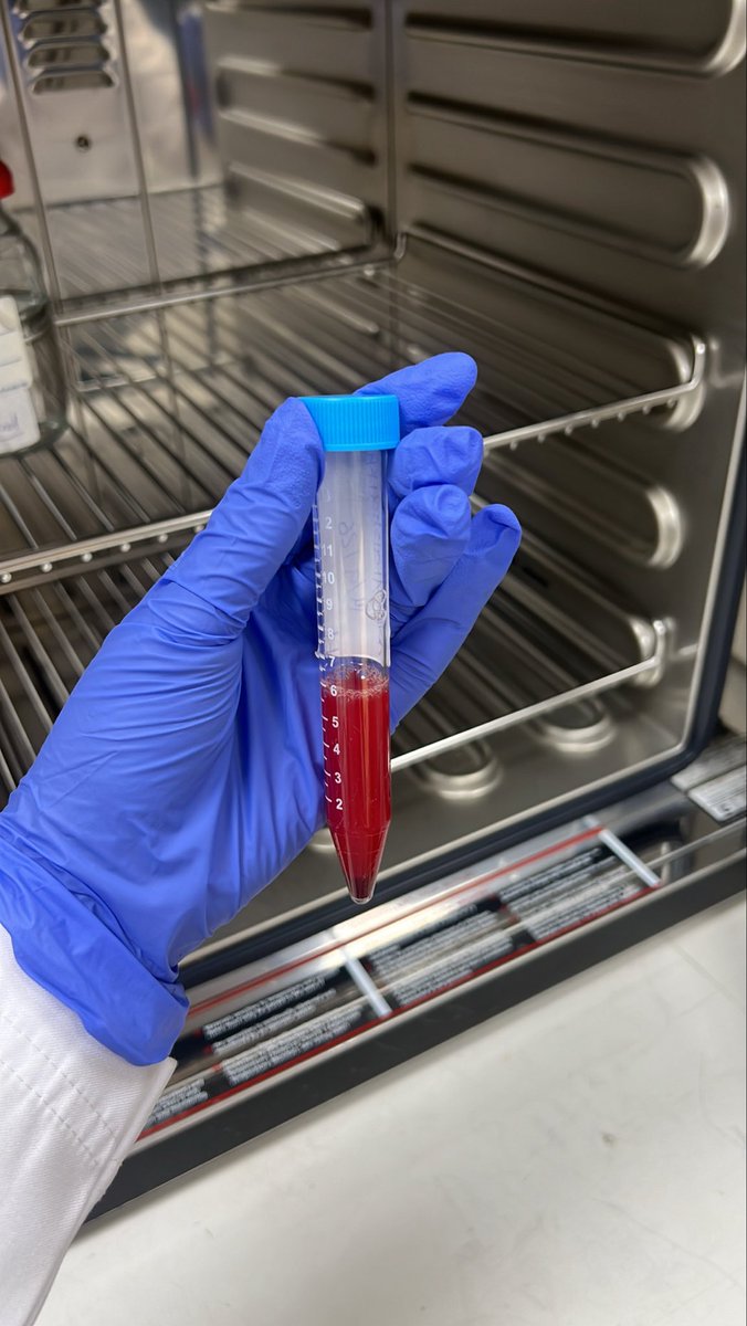 JoudMLS's tweet photo. Harvest test 🧬. https://t.co/jldwnoTRTU