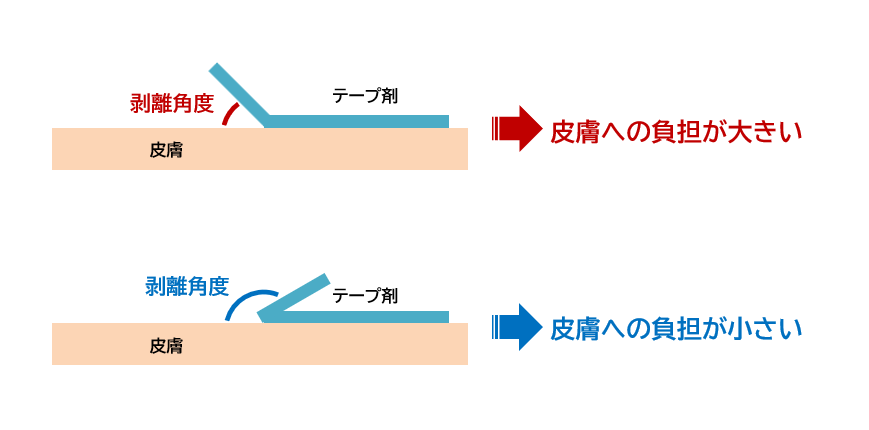 Fizz_DI's tweet photo. テープ剤を剥がす際、「剥離角度」が150°付近のときに角質へのダメージが最小になった、という報告。

Skin Res Technol.10(4):271-7,(2004) PMID:15536659 https://t.co/OTBmQT9R5v