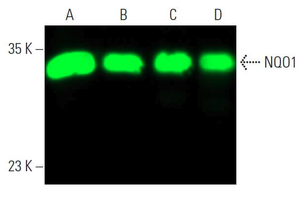 SantaCruzBio's tweet photo. Don’t sleep on NQO1 Antibody (A180)  🧬A reliable tool for oxidative stress &amp; detox research—because even the quietest targets can pack a redox punch. (sc-32793)  https://t.co/ckC5aNNrGx https://t.co/EuW5v2HHYS