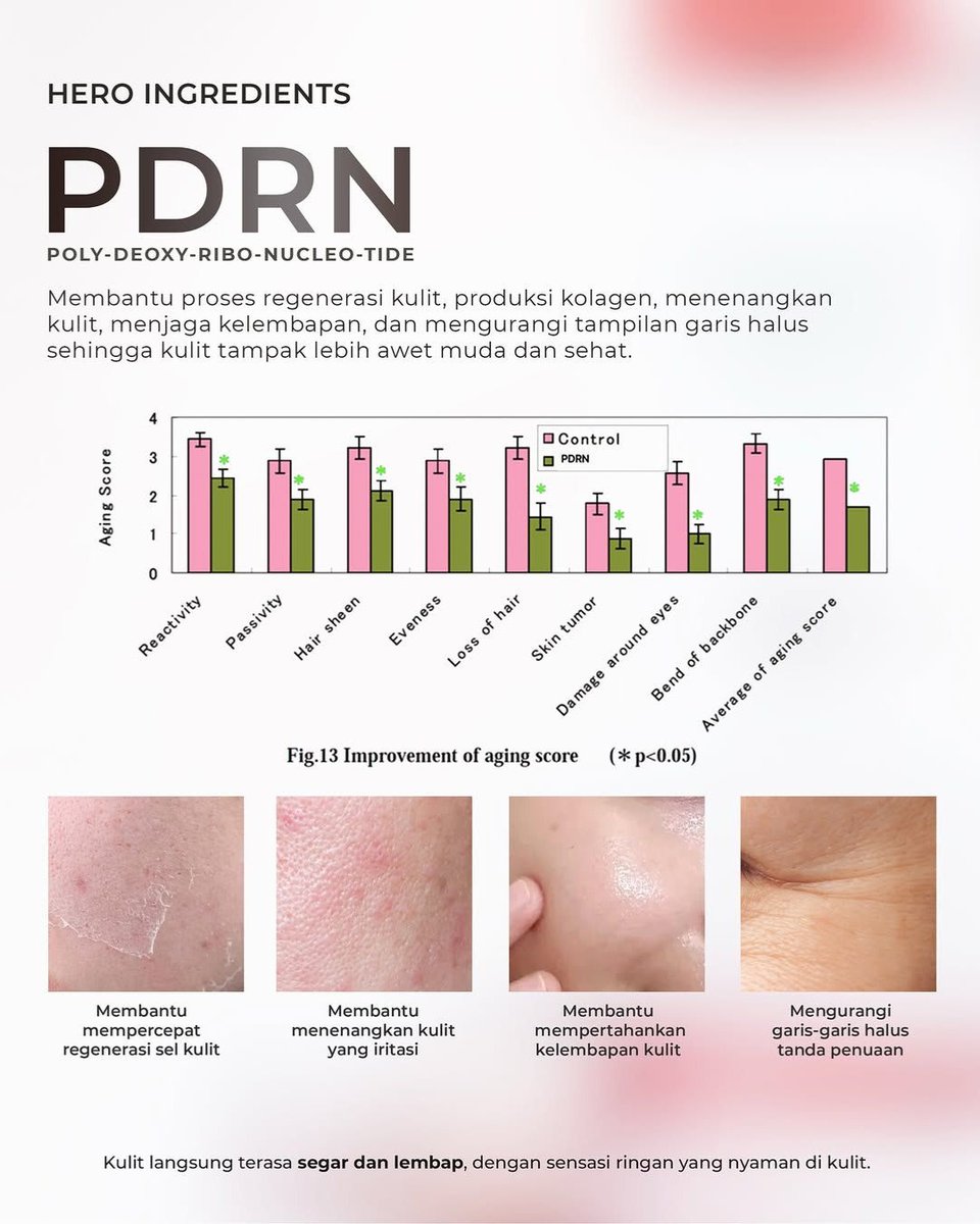 WondaGleitr5dk's tweet photo. Upgrade your skincare routine with the latest innovation from MK SKIN: PDRN Hydra Serum Spray! It delivers instant hydration, skin rejuvenation, and extra protection with advanced technology and premium ingredients. Its lightweight texture and https://t.co/XacCLBgOi8