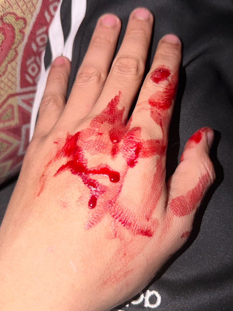 AbodMema1's tweet photo. Hello everyone. 
Today I woke up by the concrete falling on me, and I found my hands full of blood because of the stones that fell on me. 

We are forced to live in this destroyed house because there is no other option for us.
We sleep every day thinking that what if anything bad happens to us? What will we do if we find people surrounded by stones and dust?
Everything here is very difficult. Our life here is hell. 
It's hard to imagine yourself living in a place of death that follows you everywhere while people outside live their normal lives and enjoy their time.

Please stand with me and treat me as a person of your family to solve this problem.
I hope you can help me to fix this room so that we can sleep in it safely🙏 

https://t.co/QcF63UvM59