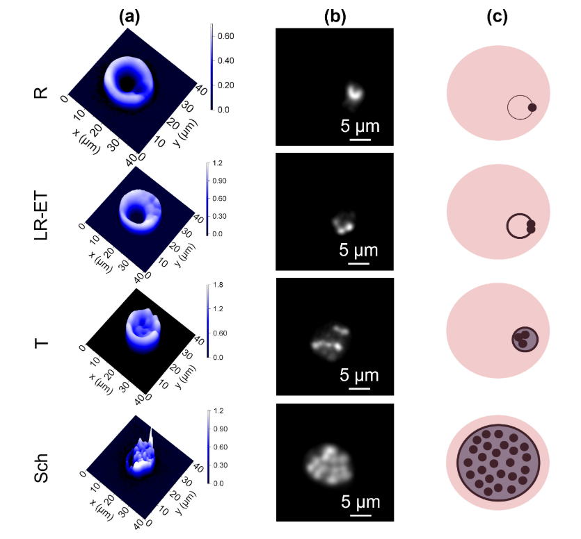 ASMicrobiology's tweet photo. Natural, non-genetic variation among host cells can shape infection outcomes. In #mSystems: variability in hemoglobin content among individual red blood cells modulates nutrient consumption by Plasmodium falciparum, the most lethal malaria parasite. https://t.co/iW3HKDulvB https://t.co/e4pQUKWPC9