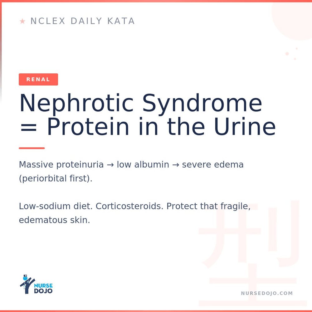 NurseDojo's tweet photo. 🥋 Daily Kata — Renal

Nephrotic Syndrome = Protein in the Urine. Massive proteinuria → low albumin → severe edema (periorbital first). Low-sodium diet. Corticosteroids. Protect that fragile, edematous skin.

#NCLEX #NursingStudent #NCLEXtips https://t.co/76nsPNcu0v