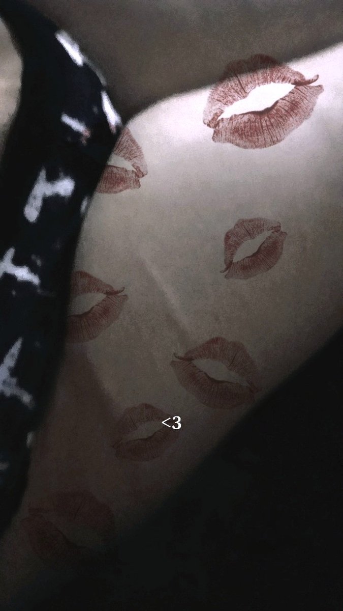 vamp_scars's tweet photo. 𓏲𑁘MY My what a blank canvas. I can't wait to paint!𓏲੭ #shtwtt #sh #toxiclove #scars #shrecovery #shsfx #sfx https://t.co/JRPYONLHth