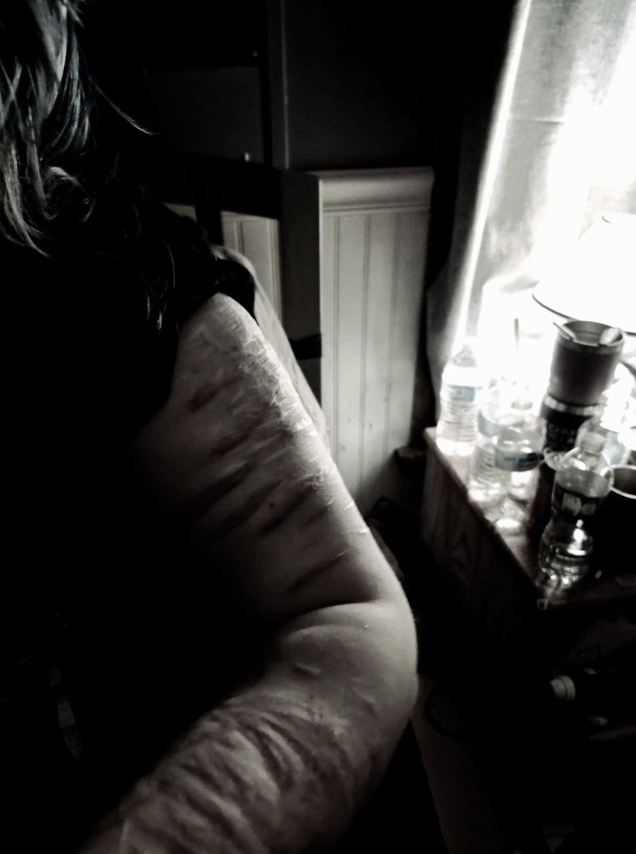 vodkafvcker's tweet photo. ai generated scars! chatgpt is great man #shtwt #shrtwt #slittwt https://t.co/jJpVrpaqrQ