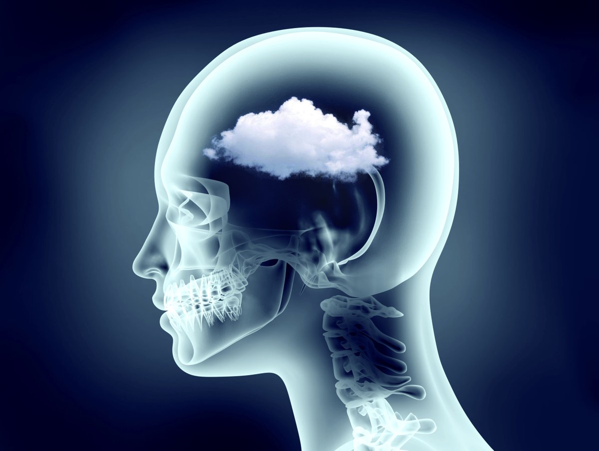 Outdoctrination's tweet photo. BRAIN FOG: It all comes down to ONE thing.

Brain fog wasn't something that was even recognized in medicine,

but that all changed over the last few years.

The amount of people complaining about brain fog became too much to ignore.

Brain fog is one of the most common + debilitating symptoms of long COVID.

This forced science to devote attention + resources to understanding it.

The causes of it were discovered:

1. Inflammation
2. A leaky brain

These issues are the driving force behind ALL brain fog.

BRAIN FOG is INFLAMMATION.

People with it have higher inflammatory markers:

➜ IL-6
➜ IL-8
➜ MCP-1
➜ IL-13
➜ IL1RA
➜ IFN-γ

The more severe the fog, the more inflammation there is.

LEAKY BRAIN also drives brain fog.

The vessels supplying blood to the brain can become compromised, and this allows:

➜ Toxins
➜ Immune cells / inflammatory proteins
➜ Pathogens

into the brain.

More blood brain barrier permeability = more brain fog.

But where does the inflammation and leaky brain come from?

While most of the attention on COVID was directed towards its respiratory effects,

COVID actually destroys the GUT,

and this is responsible a ton of the severe disease.

This is also ground zero for brain fog.

Brain fog is VERY common in people with gut issues.

➜ SIBO
➜ IBS
➜ IBDs

often times, probiotics can actually make it worse,

and antibiotics can improve it.

This tells us that bacterial overgrowth / leakage is the primary mediator of brain fog.

In fact ~90% of celiac + gluten sensitive people report symptoms of brain fog.

This tells us that gut inflammation itself is enough to drive the symptoms of brain fog.

This is because inflammation is never completely localized - the signals extend throughout the entire body.

Leaky brain is caused by systemic inflammation.

Inflammatory components:

◆ Endotoxin
◆ Cytokines (TNF-α, IL-1β, IL-6, IFN-γ)
◆ High-mobility group box‐1
◆ Cyclophilin A
◆ Sphingosine
◆ Complement components
◆ Kinins
◆ Prostaglandins
◆ Serotonin
◆ Histamine
◆ Arachidonic acid

can ALL make the blood vessels more permeable.

Inflammation poisons the brain.

All of these signals:

➔ Impair neurogenesis (new brain cell formation)
➔ Alter synaptic plasticity
➔ Disrupt neurotransmitter release
➔ Wreck mitochondrial energy production
➔ Kills brain cells (ROS)

thus, you get brain fog.

We help clients all the time with brain fog and they show high improvement rates. If you want PERSONALIZED support from us in solving it, book a free call using the link in my bio.

So the simplest way of describing brain fog is:

1. You have bacterial dysbiosis / leaky / inflamed gut
2. Systemic inflammation ensues
3. The blood brain barrier opens
4. You get inflammation in the brain
5. Brain fog

So, we have to focus on the gut, first and foremost.

2 easy and free ways to tell if you have dysbiosis:

1. Coated tongue in the morning (especially in the back)
2. Consistent foamy urine

If these are prevalent along with:

1. Other gut symptoms
2. Brain fog (especially post meal)

your gut bacteria are probably messed up.

Step 1: Reduce endotoxin absorption.

Endotoxin is one of the most powerful inflammatory signals in the entire body,

and it comes from the bacteria in your gut.

Meals higher in fat = higher absorption of endotoxin
Fiber = prevents absorption

but this only mitigates the underlying issue.

Step 2: Kill the bad bacteria

This is likely THE primary reason behind the gut (& thus systemic) inflammation.

⬩Oregano oil
⬩Allicin (garlic/onion)
⬩Mastic gum
⬩Ginger
⬩Pau D'Arco
⬩Rosemary
⬩Thyme
⬩Activated charcoal
⬩Wormwood
⬩Camphor
⬩Carrot
⬩Berberine
⬩Vitamin D
⬩Vitamin K2
⬩Zinc
⬩Lactoferrin

are just a few natural antimicrobials that can help.

Step 3: Heal the gut lining

➞ Zinc (carnosine)
➞ Butyrate (or tributyrin)
➞ Lactoferrin
➞ L-Glutamine
➞ N-Acetyl glucosamine
➞ Collagen
➞ Phosphatidylcholine
➞ Aloe vera
➞ Colostrum

are some of the best ways to seal up the gut lining.

This reduces systemic inflammation + brain fog.

A fascinating finding is that CO2 or bicarbonate is actually low in post-COVID brain fog.

CO2 has an anti-inflammatory effect, and low levels of it (or bicarbonate) predict poorer outcomes,

including brain fog.

Another huge key to reducing inflammation in the brain specifically is to clear out the glymphatic system.

Glymphatic fluid contains cellular waste, immune cells and toxins - and they can become more concentrated with a "leaky brain."

This drives inflammation in the brain.

Luteolin is a powerful remedy for brain fog.

This is a flavonoid in foods like broccoli, onions, and apples, and has the unique capability to inhibit the activation of:

➜ Mast cells
➜ Microglia

which are 2 of the most prominent inflammatory cells in the brain.

A comprehensive list of direct acting, anti-inflammatories for the brain (specifically microglia):

◆ Lithium
◆ Aspirin
◆ Taurine
◆ Glycine
◆ L-Theanine
◆ Luteolin
◆ Apigenin
◆ Baicalein
◆ Fisetin
◆ Palmitoylethanolamide (PEA)
◆ Oleoylethanolamide (OEA)
◆ DHA
◆ Melatonin
◆ Allopregnanolone (from progesterone)
◆ Pregnenolone
◆ Vitamin D
◆ Curcumin
◆ Resveratrol
◆ EGCG
◆ Honokiol
◆ Apocynin
◆ Hydrogen
◆ Escin
◆ Acacetin
◆ β-aminoisobutyric acid
◆ Corydecumine G
◆ Linarin
◆ Oxymatrine
◆ Panaxytriol
◆ Esculentoside A

There are other important sources of persistent inflammation to consider that can also contribute.

One I've written about recently is mold.

Heavy metals are another. 

Hypothyroidism can also cause brain fog.

Roughly HALF of people officially diagnosed will experience it.