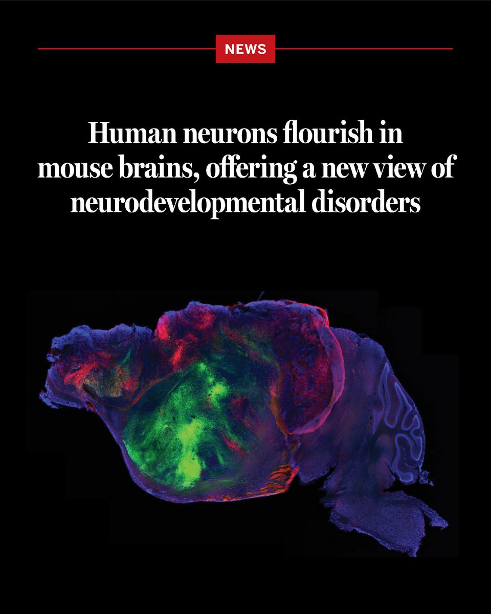 Human neurons flourish in mouse brains, offering a new view of neurodevelopmental disorders