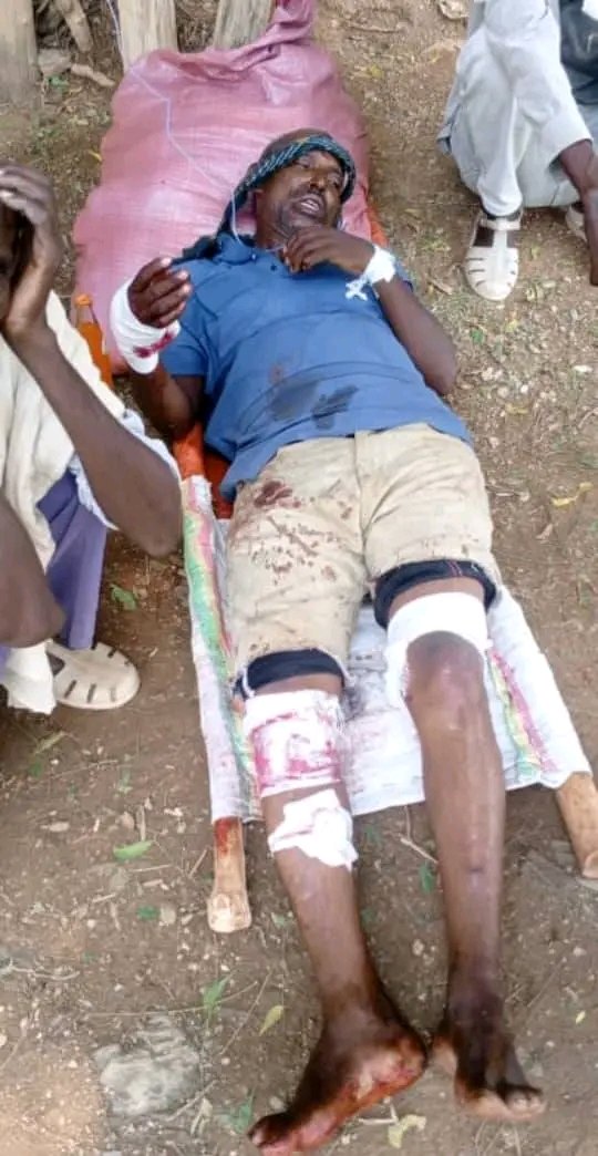 Saymen_mehari's tweet photo. 🚨 DRONE STRIKE IN DEDEBIT, TIGRAY

Today, Sept. 7, 2019 E.C., a drone strike in Tselimoy village, Dedebit Tabia, Asgede Woreda, reportedly targeted civilians in their homes. Three civilians sustained light to serious injuries and are receiving medical treatment. 
#Tigray #Dedebi https://t.co/1DivL4PzRP