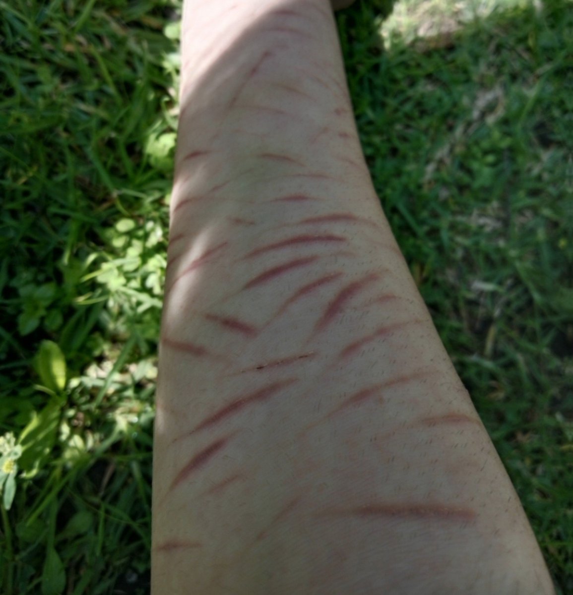 melankoliii___'s tweet photo. You'll be born again ♫⋆｡♪ ₊˚♬
#988twt #selfharm #slittwt

Practice SFX makeup (fake AI and red ink) for Halloween since it's getting near <3 https://t.co/HEpn59DXNN