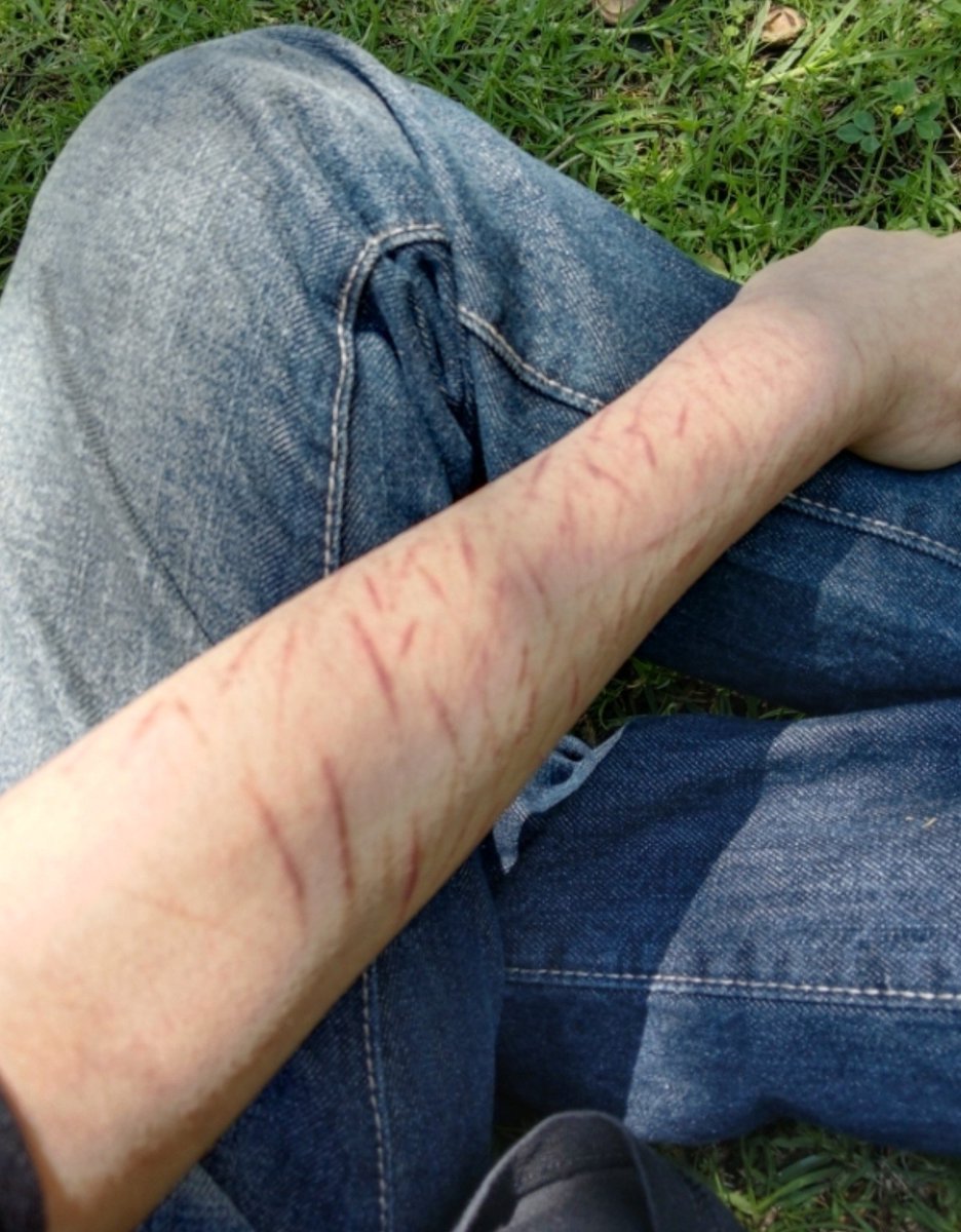 melankoliii___'s tweet photo. You'll be born again ♫⋆｡♪ ₊˚♬
#988twt #selfharm #slittwt

Practice SFX makeup (fake AI and red ink) for Halloween since it's getting near <3 https://t.co/HEpn59DXNN