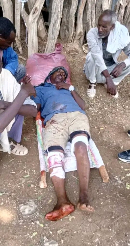 Saymen_mehari's tweet photo. 🚨💔 ABiy AHMED’S GENOCIDAL REGIME INJURES CIVILIANS IN DEDEBIT, TIGRAY

Today, Sept. 7, 2019 E.C., a drone strike reportedly targeted civilians in their homes in Tselimoy village, Dedebit Tabia, Asgede Woreda. 

#Tigray #Dedebit #Asgede #ProtectCivilians https://t.co/ZRSeOm7xed