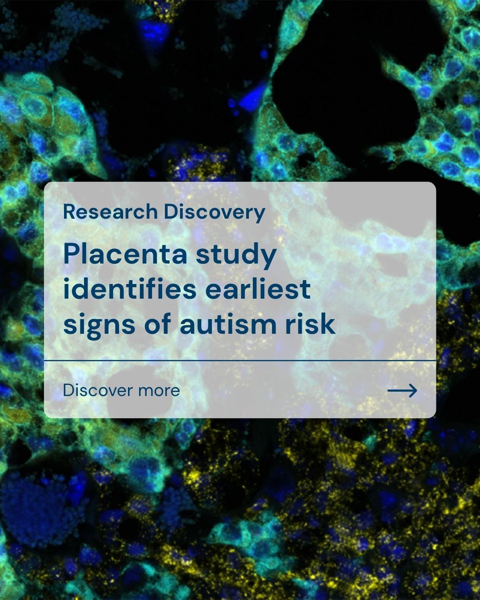 CSHL's tweet photo. New research from CSHL Associate Professor Lucas Cheadle and postdoc Irene Sanchez Martin identifies a biological mechanism linking maternal inflammation to autism risk.

In a new study, the Cheadle lab found that inflammation during a critical window of pregnancy can contribute to autism-like traits in male mice.

Researchers triggered a controlled immune response, mimicking a viral infection without introducing an infectious virus, at different stages of pregnancy. They found that fetuses were most susceptible to developmental abnormalities at 12.5 days.

Across the experiments, male mice developed autism-like traits, while female mice did not show the same traits.

So, why were some pups affected while others weren’t? Researchers turned to the placenta for answers.

The takeaways:

🔹 A biological link: The study identifies a specific mechanism connecting maternal inflammation with autism-like traits.
🔹 The immune system matters: The findings add to evidence that immune responses during pregnancy may play an important role in neurodevelopment.
🔹 Sex differences offer clues: The results may help explain why autism is diagnosed more often in males.
🔹 Potential therapeutic implications: Understanding how maternal inflammation affects fetal development—and why effects differ by sex—could eventually help researchers develop more targeted approaches.

Learn more about the study, its key findings and where the Cheadle lab is taking this research next: https://t.co/3ieliBqCeL

#InspiringCuriosity #AutismAcceptance #Autism #ScienceMakesLifeBetter