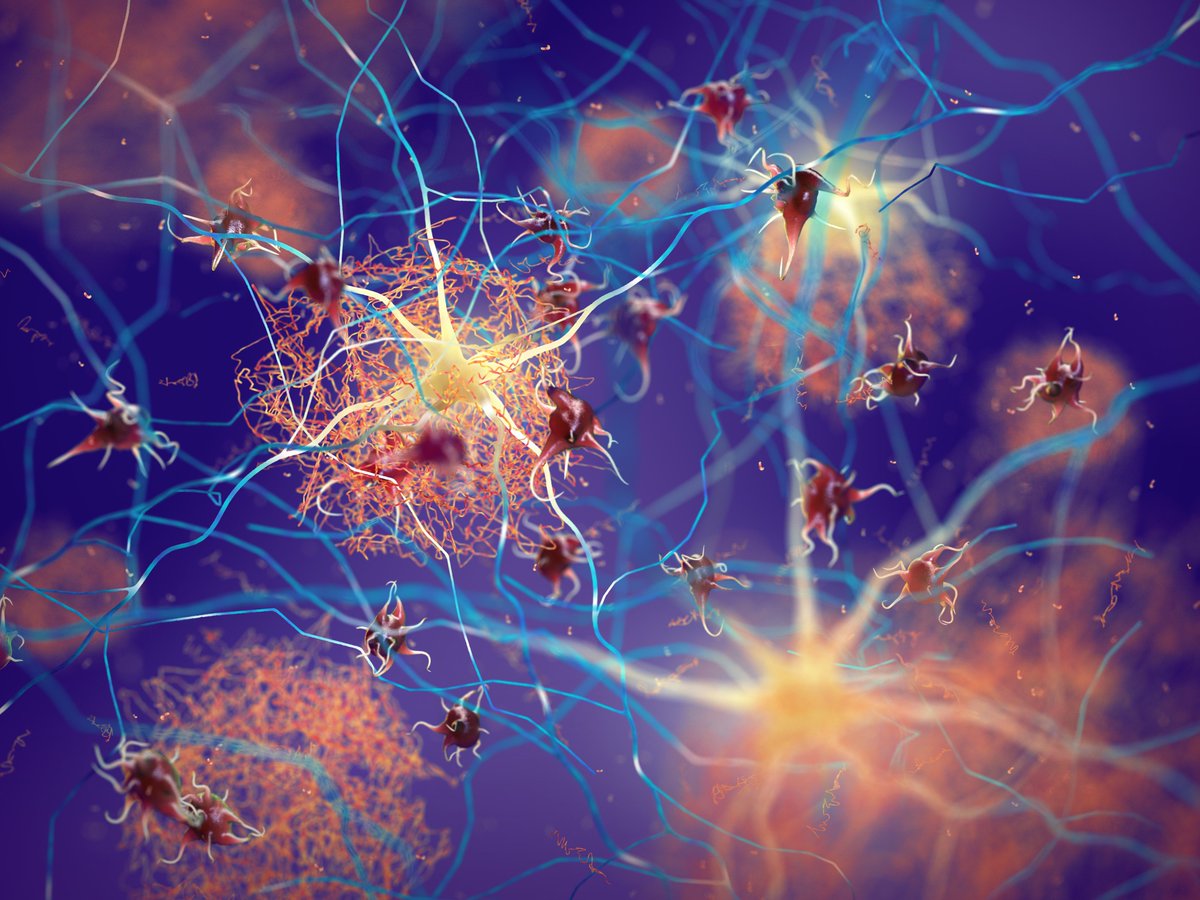 psc_live's tweet photo. Fibrils, protein chains that gum up a cell’s works, underlie many degenerative diseases. A team led from @UTAustin used Bridges-2 to uncover clues as to how fibril formation happens, and possibly how it could be better prevented.

https://t.co/S2wzIAOGYG https://t.co/JC3714bs2z