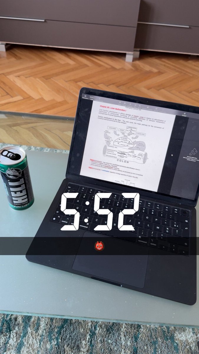loic_camus's tweet photo. Alors que la vrai uni student life c’est ça (j’ai pas mis les photos ou je pleure j’ai trop de fierté mais elles existent mdr) https://t.co/nih0ap54ws