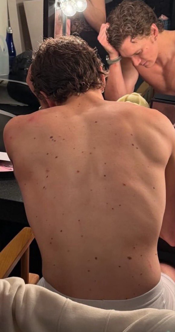 hudcstorrie's tweet photo. his body is full of stars https://t.co/7cTyv4eSxv