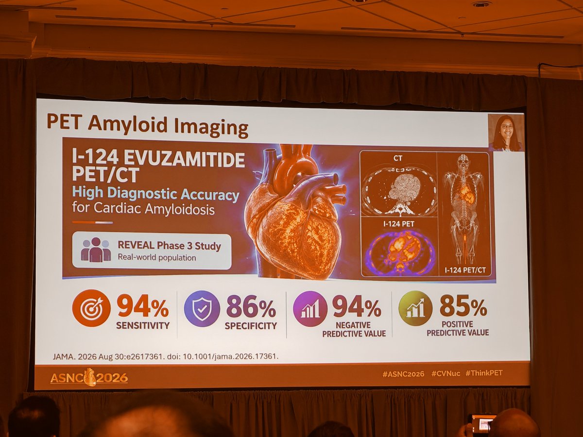 estelais's tweet photo. The future of Nuclear Cardiology #ASNC2026 @MyASNC @almallahmo 
🫀Total body pet perfusion imaging
👉 Evuzamitide for Amyloidosis
👉 Patient centered care https://t.co/q6EFp2acsg