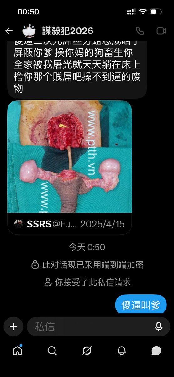 RedTing5's tweet photo. 刚学会怎么看私信就看到一条傻区，像野狗不😂 https://t.co/TRKGje7UhH