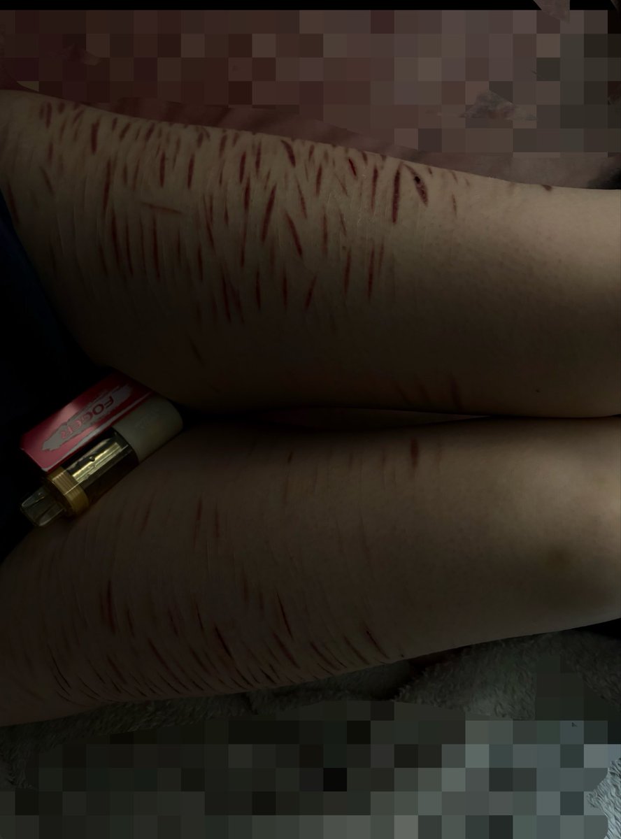va1ent1nezz1's tweet photo. sc@r check 

[ fake sfx makeup, :3] https://t.co/68leg306bh