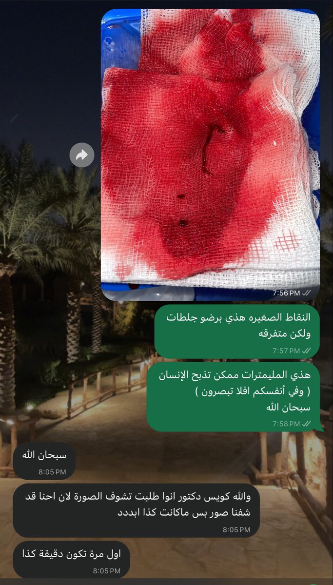 Sal_95q's tweet photo. (انتهى الوقت لكن الفضول زاد)
تكلمنا اليوم عن الـMI، دائمًا أربط المعلومة والدراسات بخبرتي الإكلينيكية.
انتهت المحاضرة وبقي طلبهم لصورة واقعية من الـCath Lab 
هذا الفضول العلمي وحب الاستطلاع هو اللي يخلي للتعليم معنى مختلف .
وكل يوم أعلّمهم ،و أتعلم منهم شيء جديد https://t.co/IAIV3hhBut