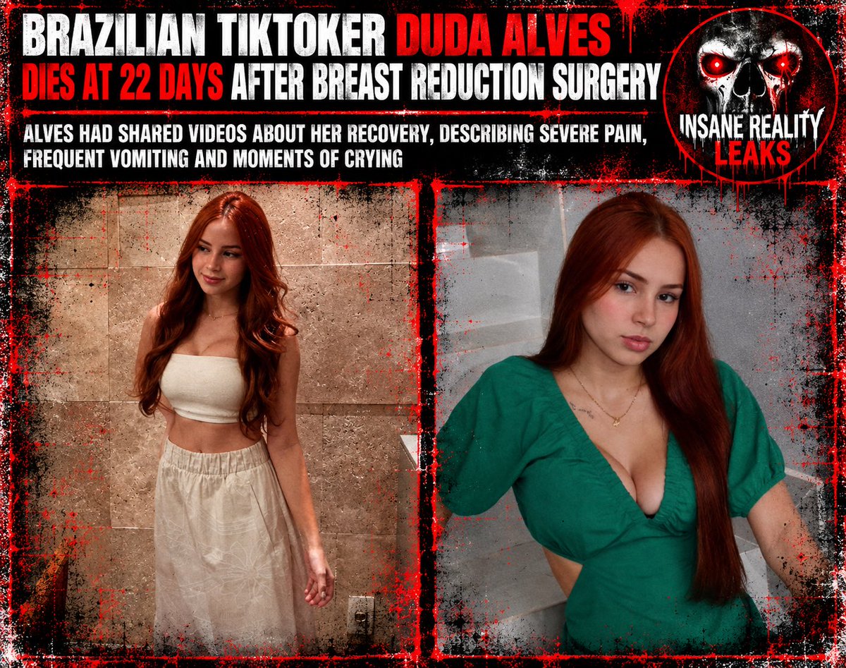 InsaneReality's tweet photo. Brazilian creator Duda Alves died at 22 on September 13, only weeks after undergoing breast surgery and documenting a difficult recovery online. In her final posts, she spoke about severe pain, frequent vomiting and crying during recovery.  

However, authorities have not established that the procedure caused her death. Brazil’s Federal District Civil Police is investigating the circumstances, and no official link between the surgery and her death has been announced.