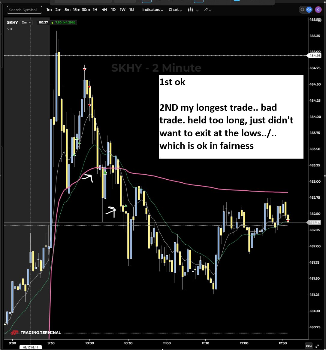 ResilientLoser's tweet photo. OK. 1st lag trade, good. 2nd held on for too long, it was painful. Its not my stype holding on underwater knowing i shouldnt be in it, but also it would be poor to exit at the lows (which it kept on revisiting) decided a hard stop would be a bad idea. and it would have been. https://t.co/S2fYrW5j8C
