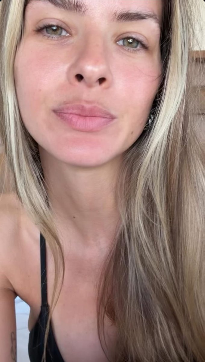 amoranimal2020's tweet photo. Al natural, con sus imperfecciones tan perfectas! 😍
Como siempre dije, 25 años trabajando, el año pasado metiendo dos éxitos. Te mereces un jueves libre y muchos años mas!. Las haters contestan al segundo de tu publicación, al final son mas fan que nosotros. jajaja
#LaMasBella https://t.co/qwtCPzAqVv