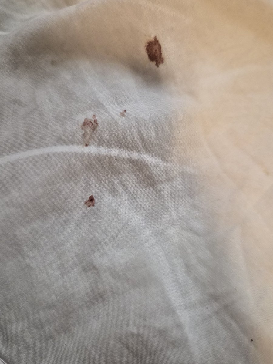 VoiidsDecay's tweet photo. omfg theres blood all over my bed https://t.co/mtg7b96E7J
