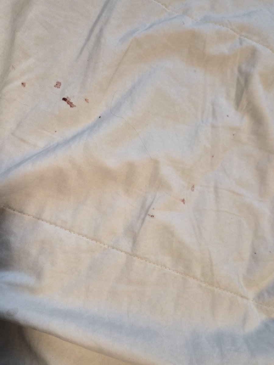 VoiidsDecay's tweet photo. omfg theres blood all over my bed https://t.co/mtg7b96E7J