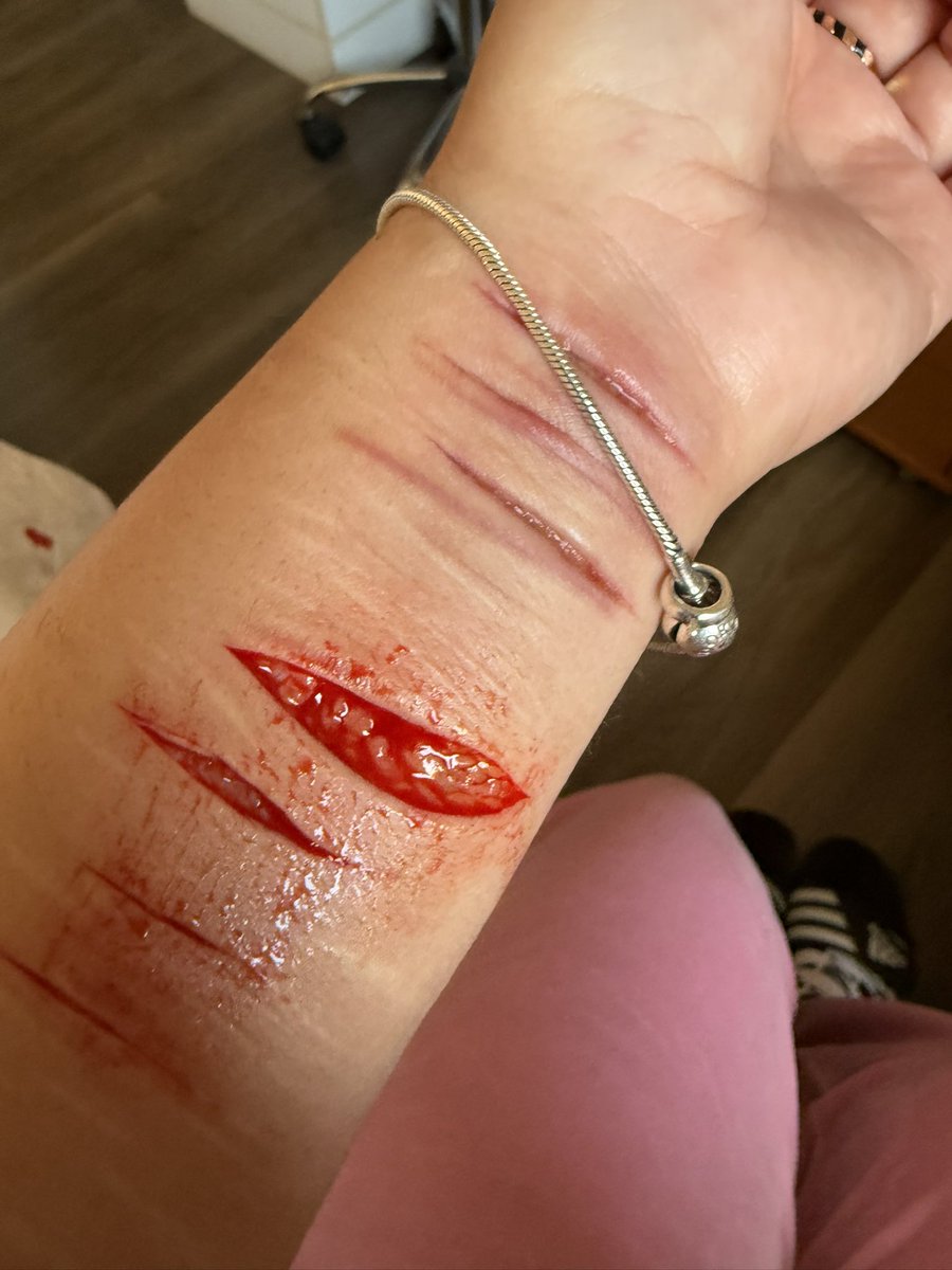 122cal's tweet photo. nmrl, mandei bem nessa maquiagem, parece muito real, isso é SÓ maquiagem, não fique aflito, vou tirar depois do teste sfx makeup #makeup #sfxmakeup #fake #shrtwt https://t.co/yxYjsi7PIC