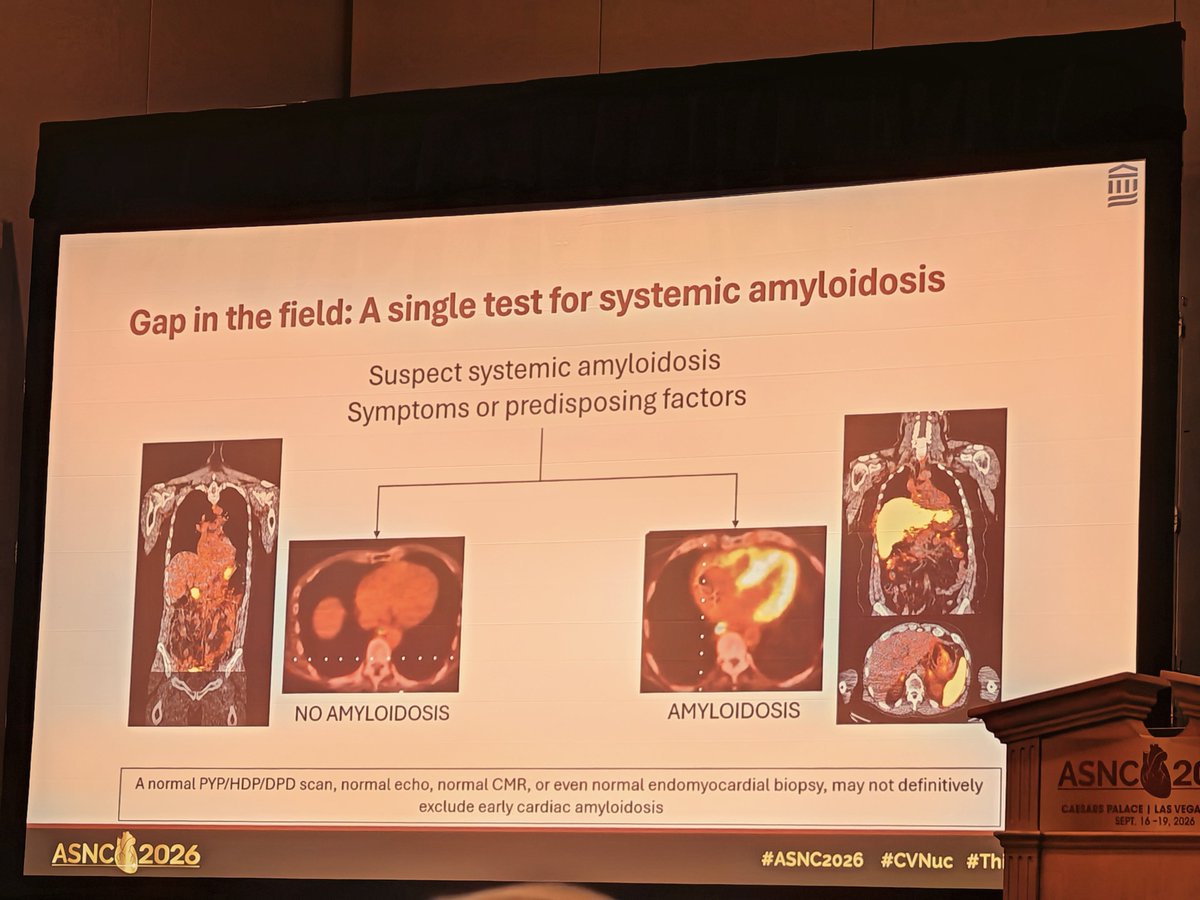 estelais's tweet photo. Late breaking clinical trials: #Reveal study โจ#ASNC2026 @MyASNC @DorbalaSharmila
๐ Evuzamitide 124Iodine
๐ Is necessary because not all Amyloidosis can be detected by PYP and either the entire body can be evaluatedโก๏ธ #ThinkPET #ThinkAmyloid https://t.co/wUuYOheNmd