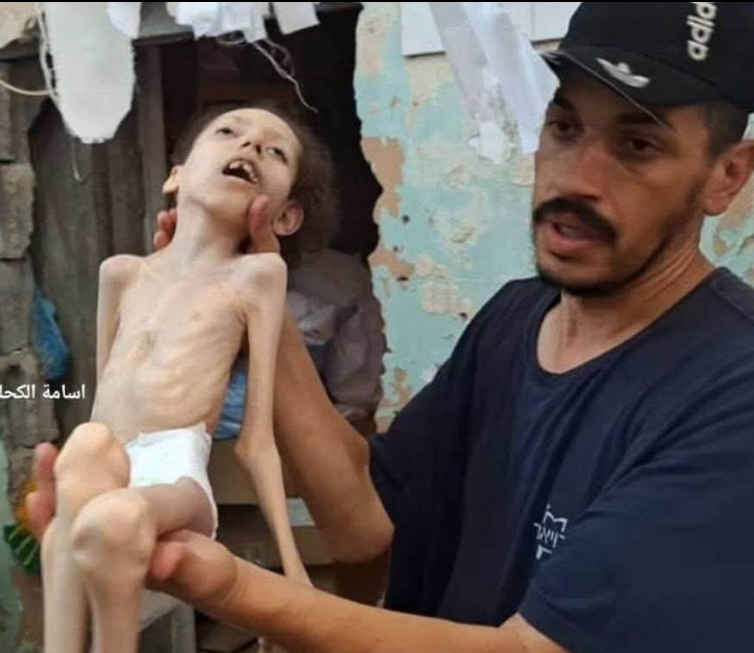 ros_sara2002's tweet photo. Forced starvation in Gaza is an act of genocide. https://t.co/XF1hpM3eF6