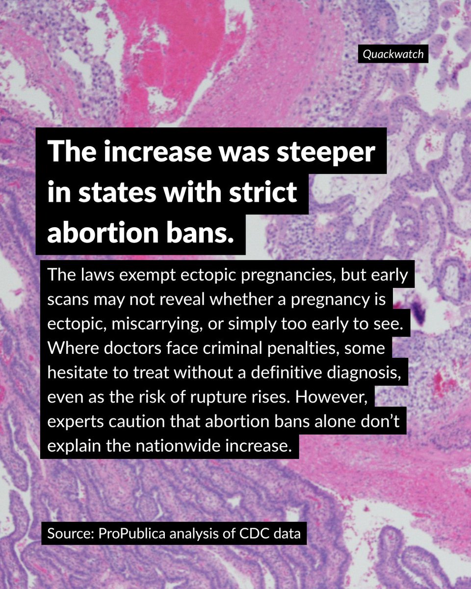 center4inquiry's tweet photo. Magnets can’t make water more watery. Meanwhile, deaths following ectopic pregnancies nearly doubled from 2020–2025 compared with the prior 6 years.

This week’s @Quackwatch21 follows the evidence from expensive nonsense to matters of life and death:  https://t.co/46S44AWIt4 https://t.co/feKDI8HZpu